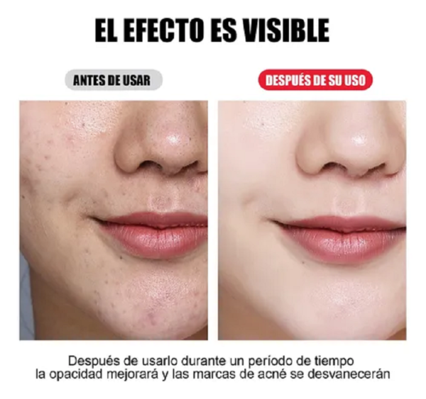 ✨ Máscara LED Facial 7 Colores Terapia de Luz | Rejuvenecimiento y Cuidado Profesional en Casa